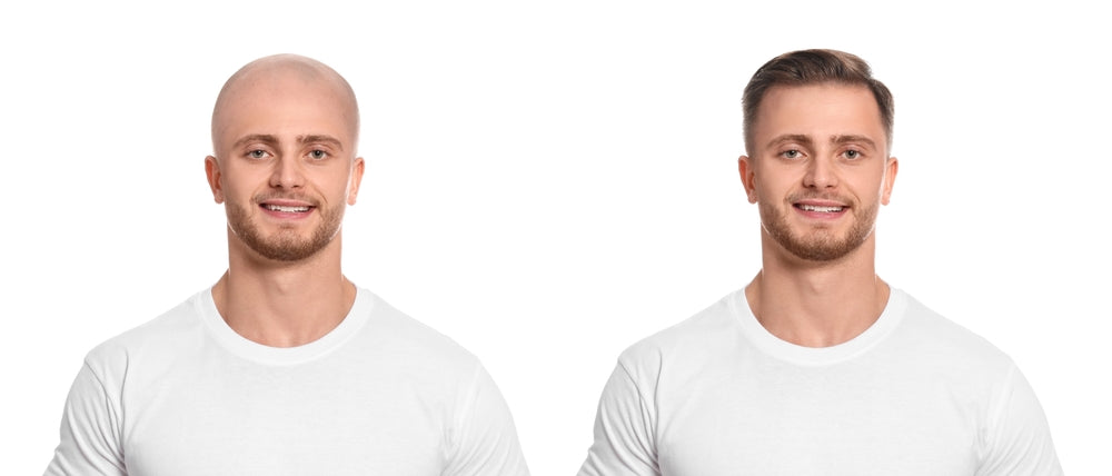 Lace Types Decoded: HD vs. Transparent vs. Swiss