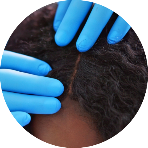 FREE Medical Wig Consult Hover Image